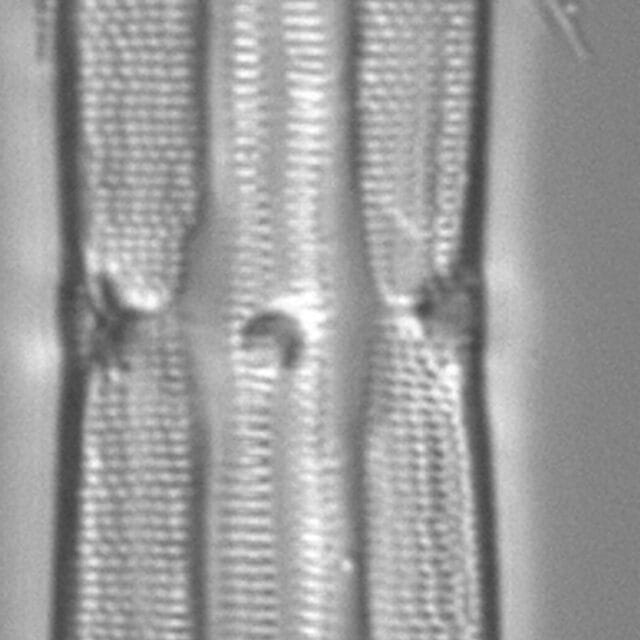 Tursiocola varicopulifera LM5