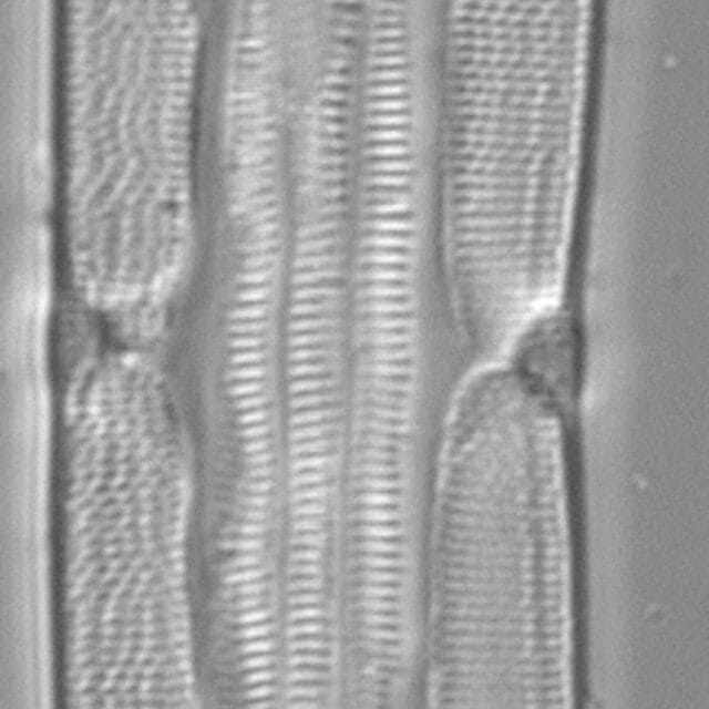 Tursiocola varicopulifera LM6