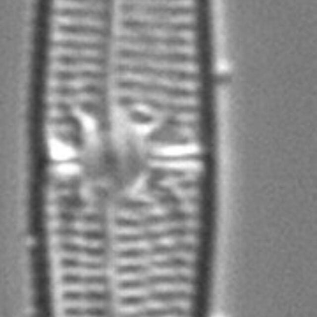 Tursiocola ziemanii LM1