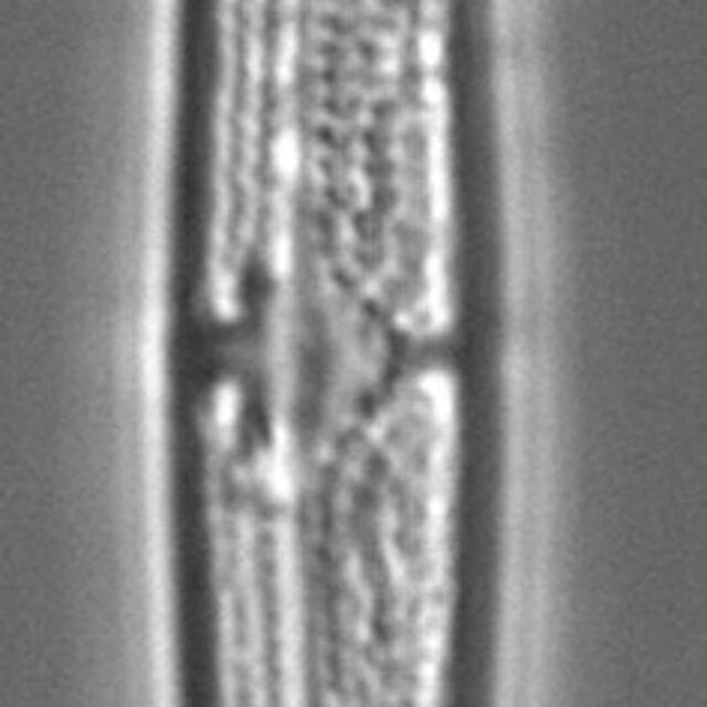 Tursiocola ziemanii LM2