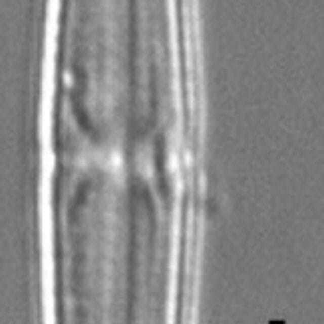 Tursiocola ziemanii LM4