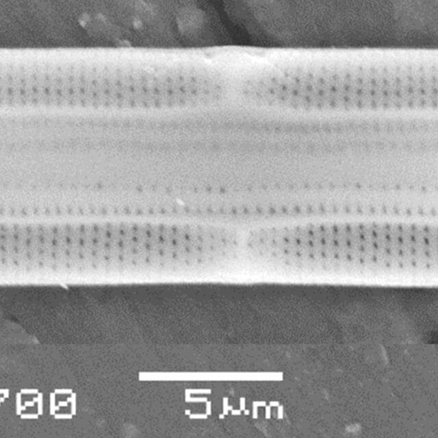 Tursiocola ziemanii SEM1