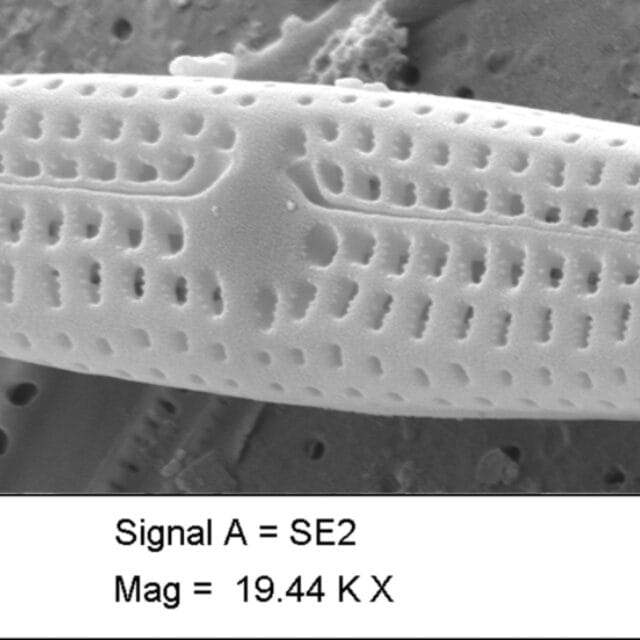 Tursiocola ziemanii SEM3