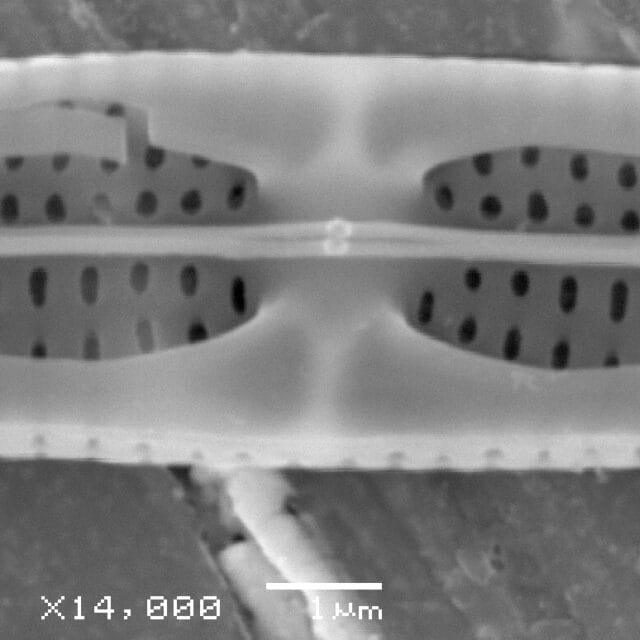 Tursiocola ziemanii SEM5