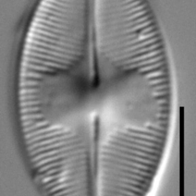 Eucocconeis americana LM4