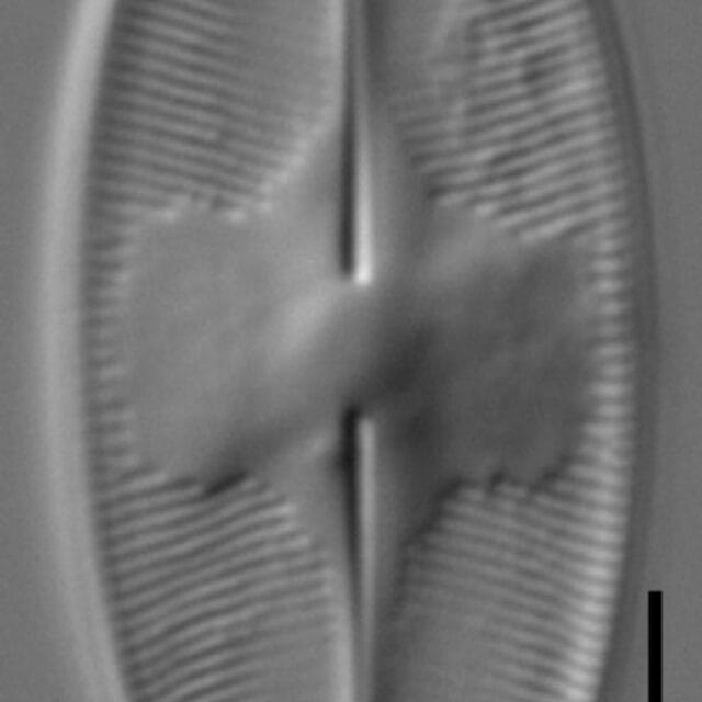 Eucocconeis americana LM5