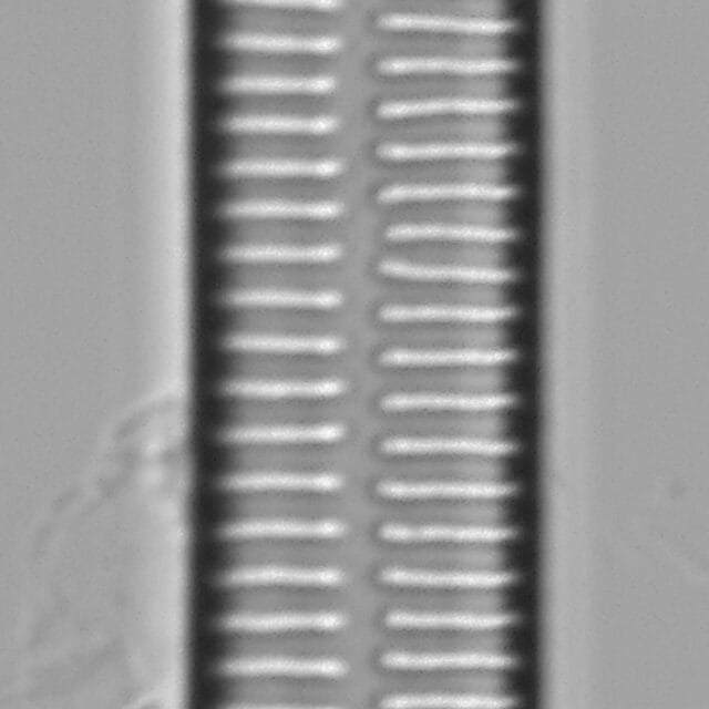 Ulnaria Capitata LM1