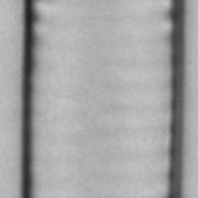 Ulnaria contracta LM2