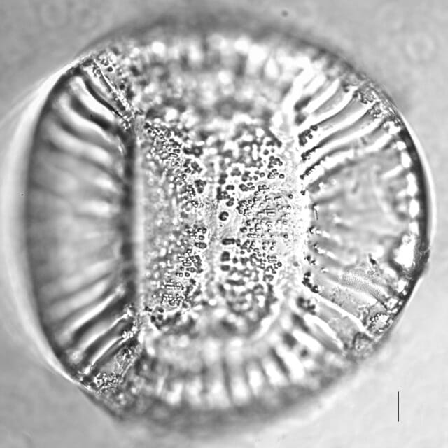 Campylodiscus clypeus_LM7