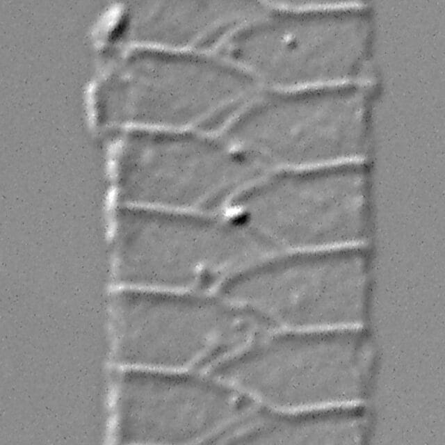 Urosolenia Eriensis Lm2