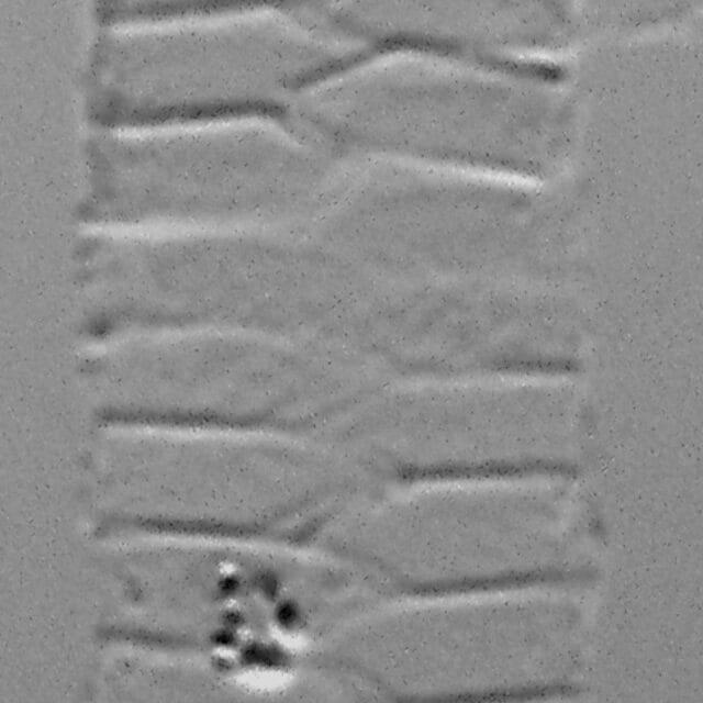 Urosolenia Eriensis Lm4