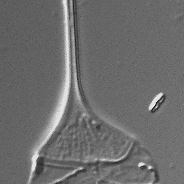 Urosolenia Eriensis Lm6