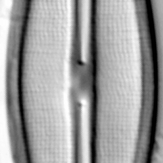 Frustulia crassinverva LM5