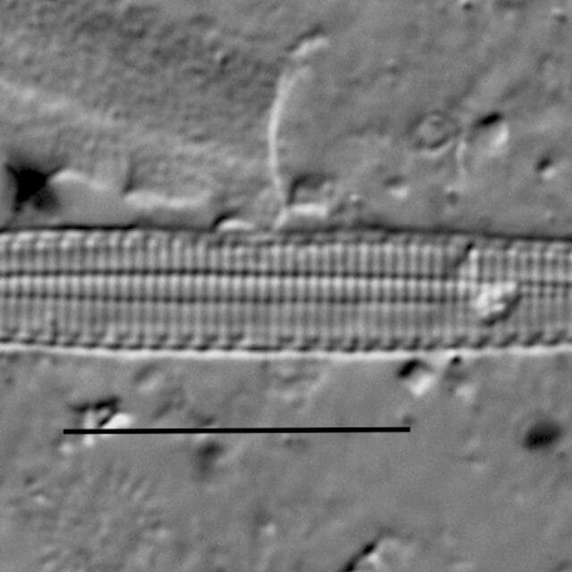 Duplicate Subacicularis 113094A 003