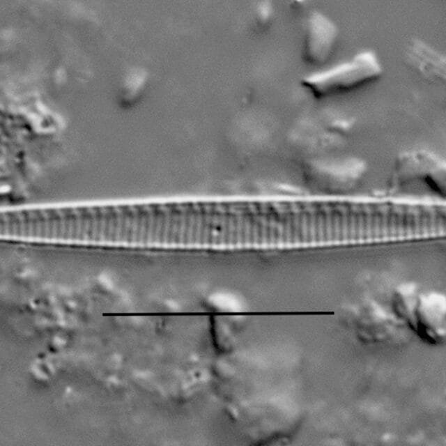 Duplicate Subacicularis 113596B 002