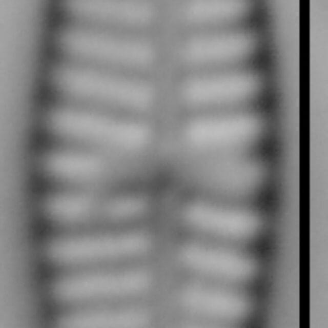 Hip Pseud 15578A 09182015 01 Cl