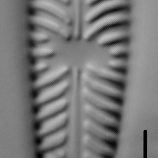 Gomphoneis olivaceum LM6