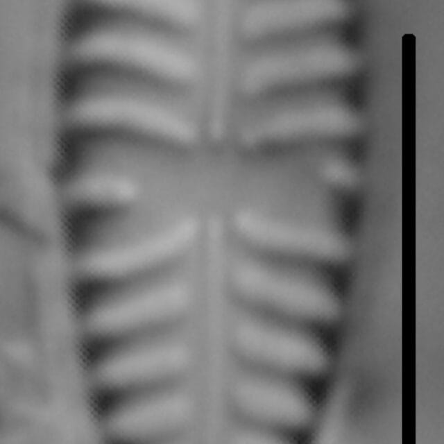 Gomphoneis olivaceum LM2