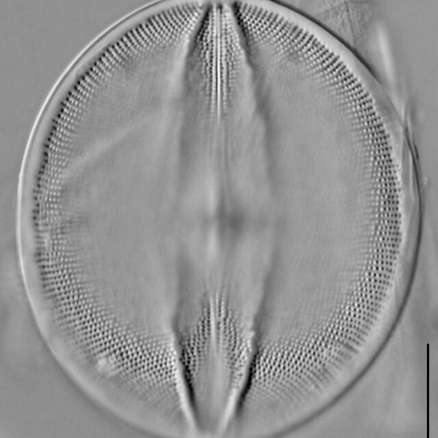 Cocconeis rugosa LM5