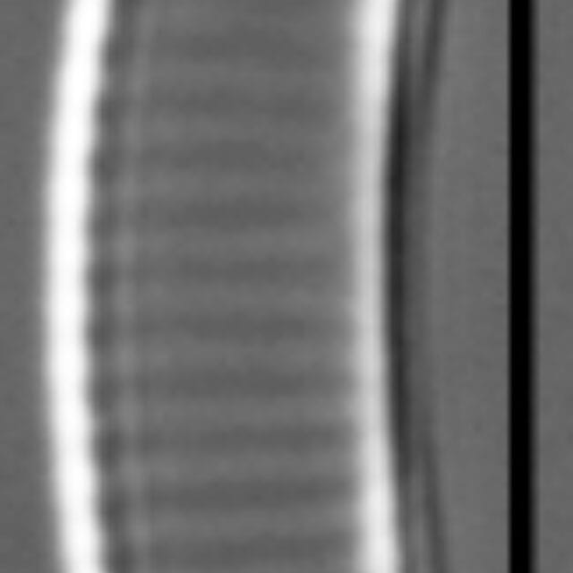 Eunotial tenella LM5