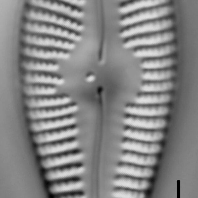 Gomphonema ventricosum LM2