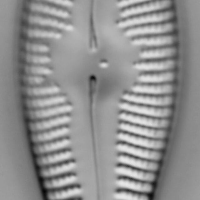 Gomphonema ventricosum LM1