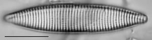 Nitzschia angustata LM3