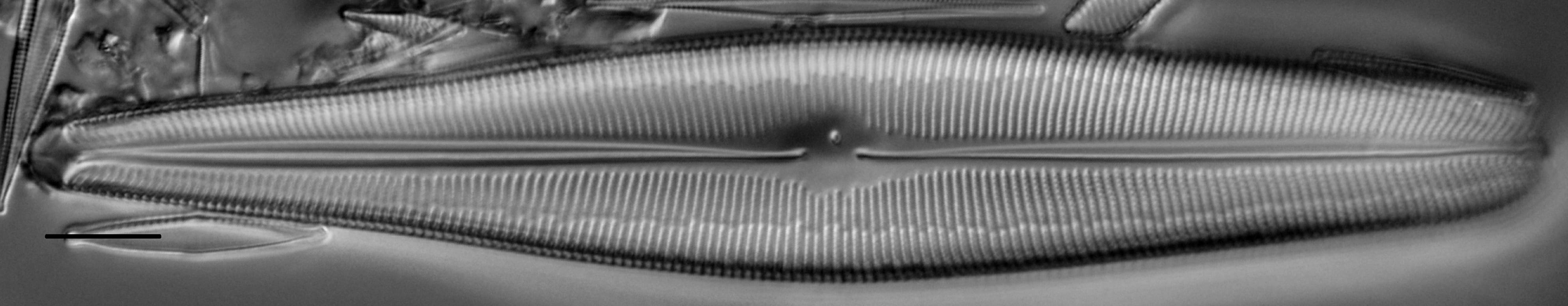 Gomphoneis herculeana var. abundans LM2