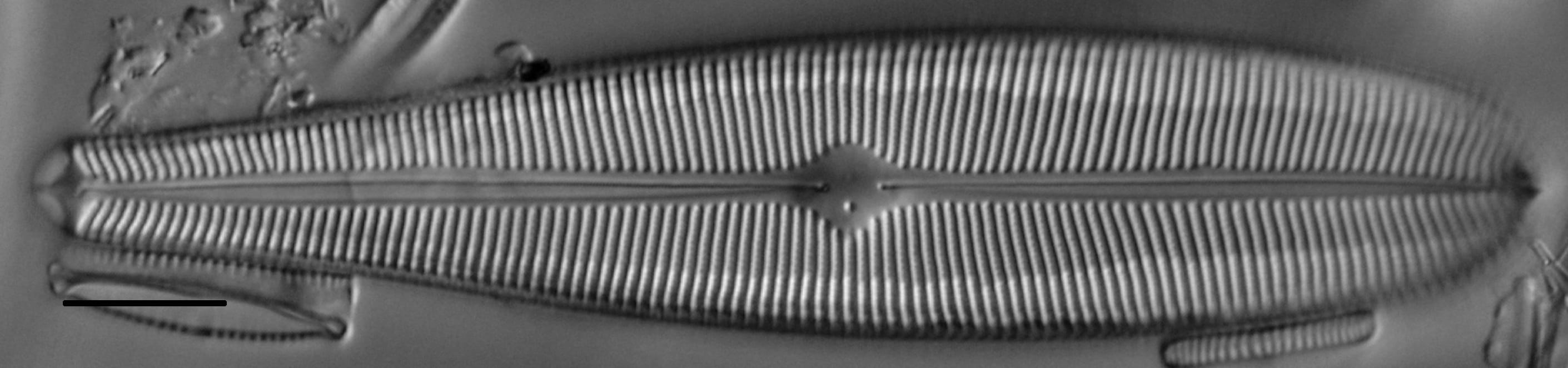 Gomphoneis herculeana var. abundans LM3