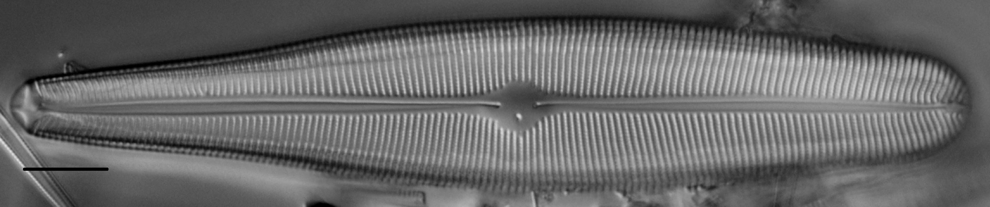 Gomphoneis herculeana var. abundans LM4