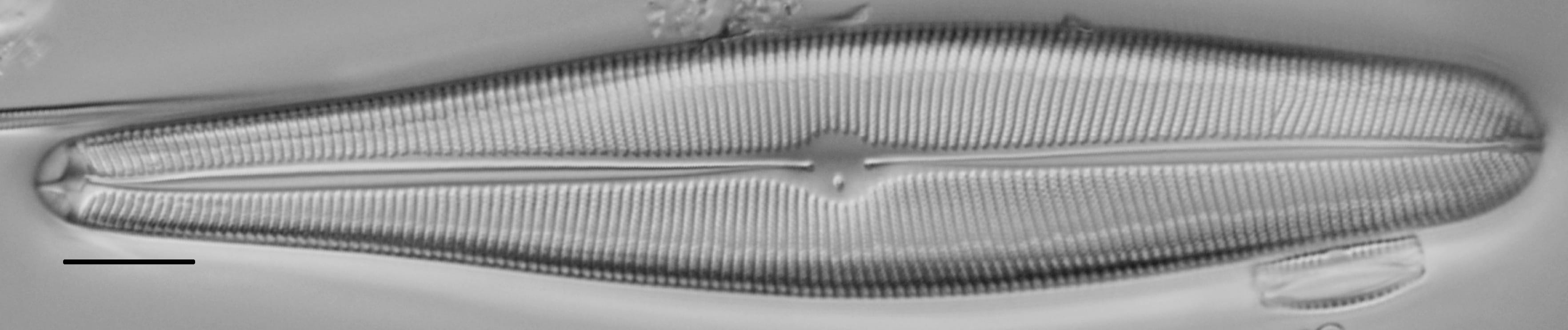 Gomphoneis herculeana var. abundans LM5