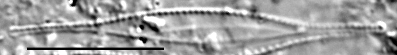 Nitzschia acicularis LM5