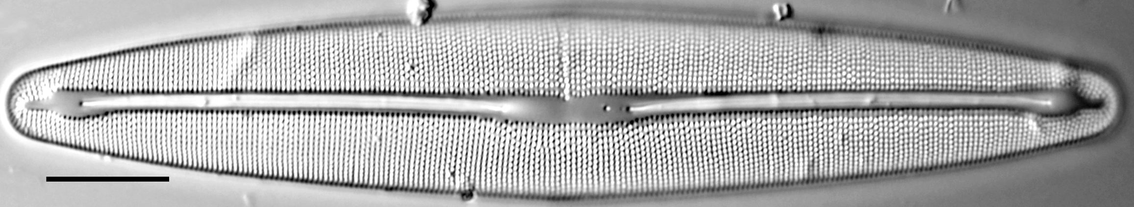 Frustulia amphipleuroides LM1