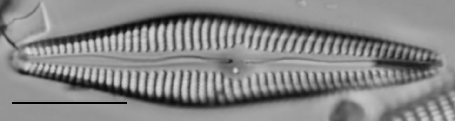 Gomphoneis eriense var. angularis LM4