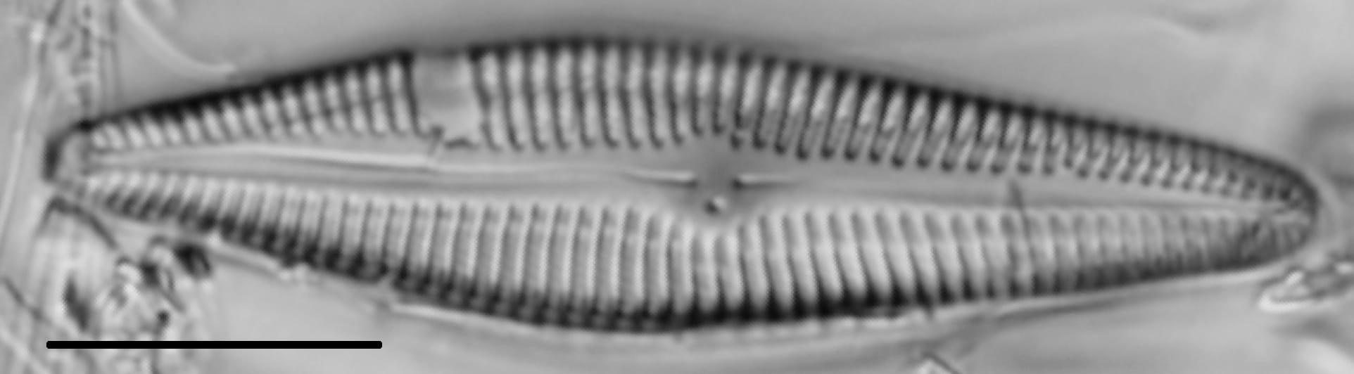 Gomphoneis eriense var. angularis LM5