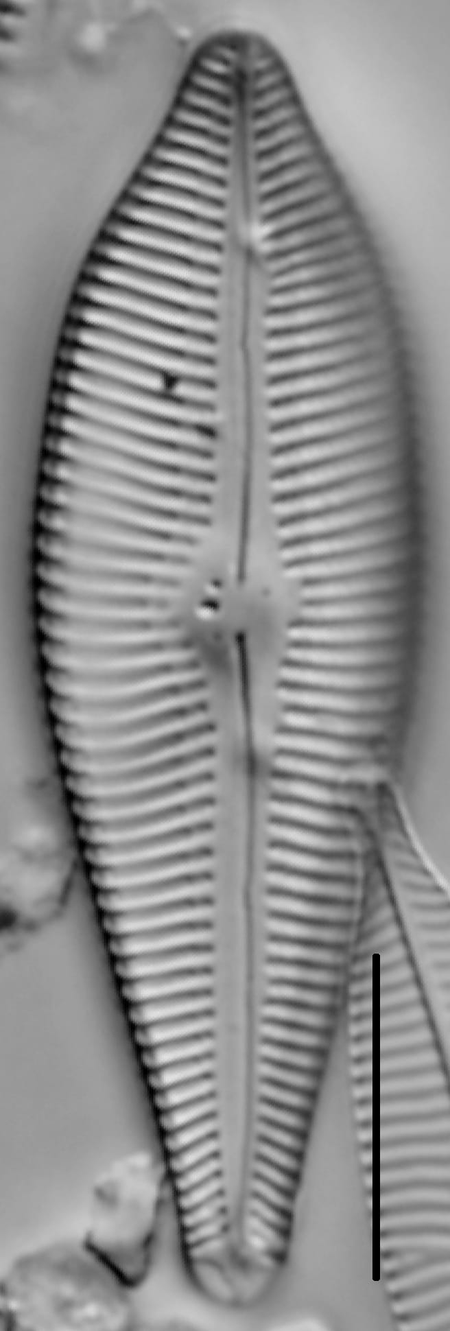 Gomphoneis eriense var. apiculata LM3