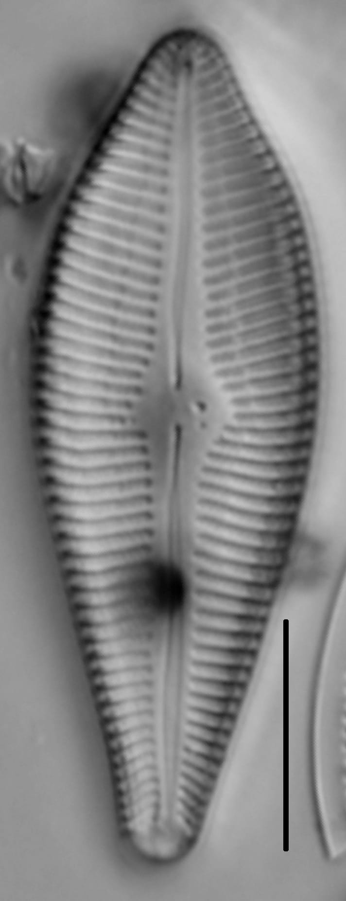 Gomphoneis eriense var. apiculata LM1