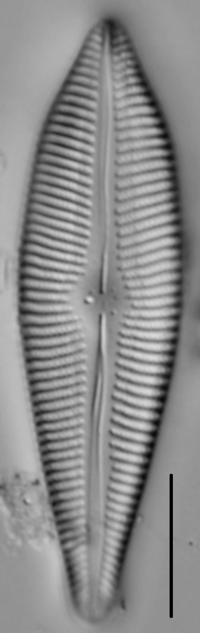 Gomphoneis eriense var. apiculata LM2