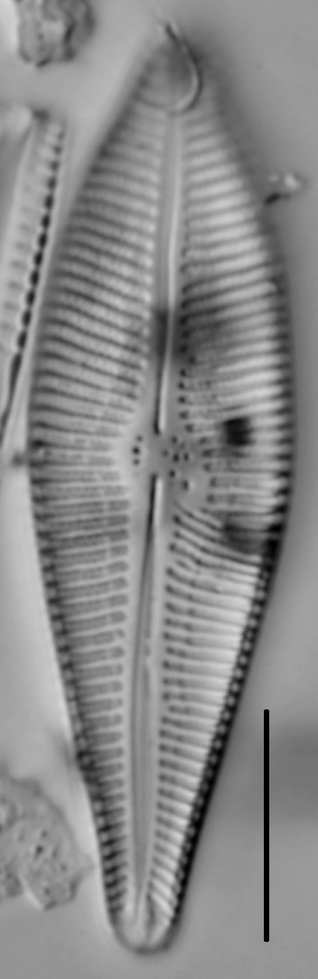 Gomphoneis eriense var. apiculata LM5