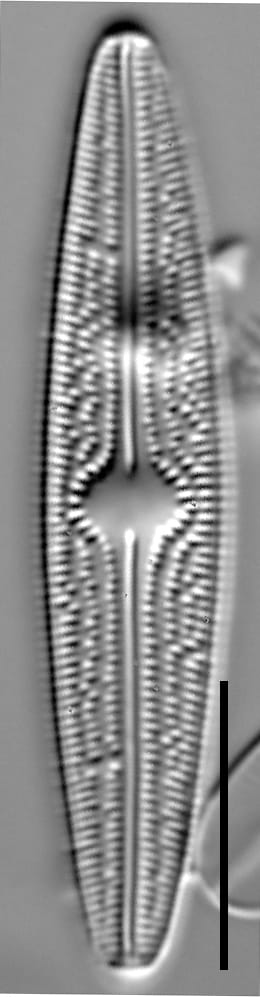 Brachysira confusa 002