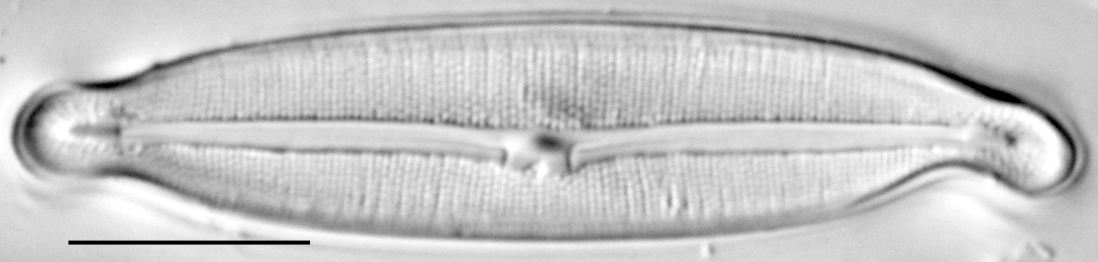 Fragilara capitata LM1