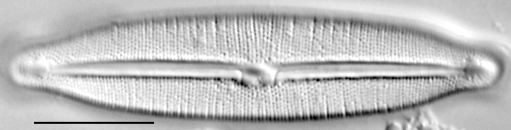 Fragilara capitata LM2