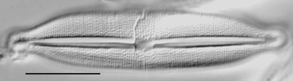 Fragilara capitata LM3