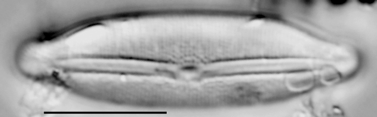 Fragilara capitata LM5
