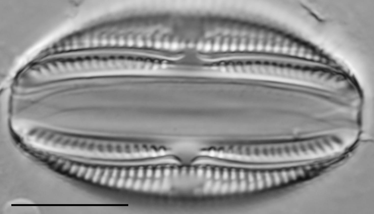 Amphora copulata LM1
