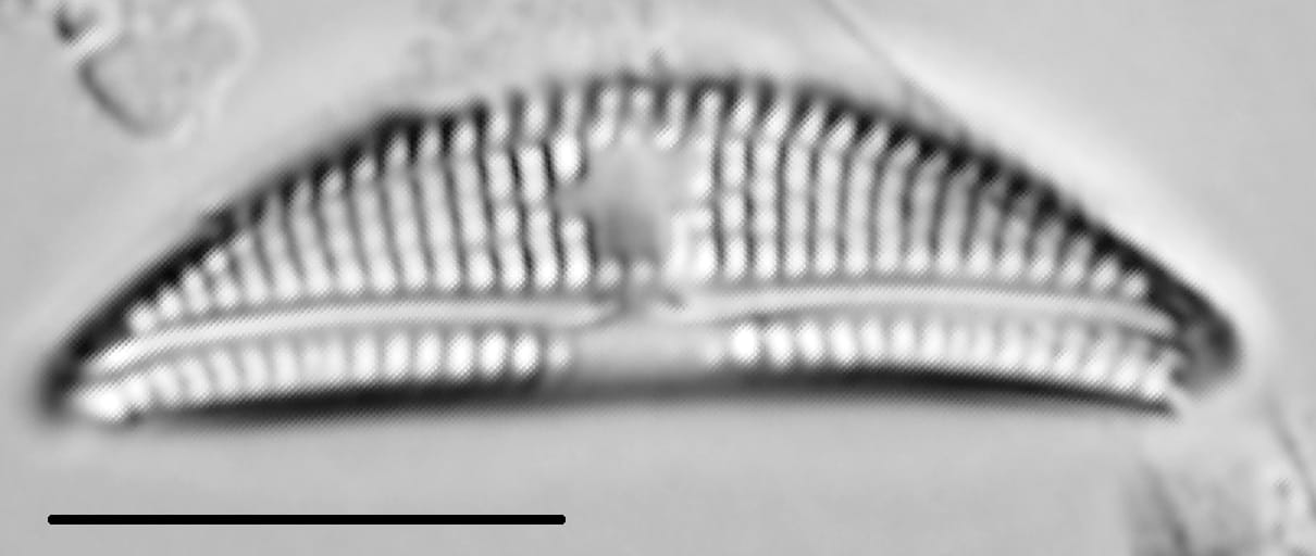 Amphora copulata LM2