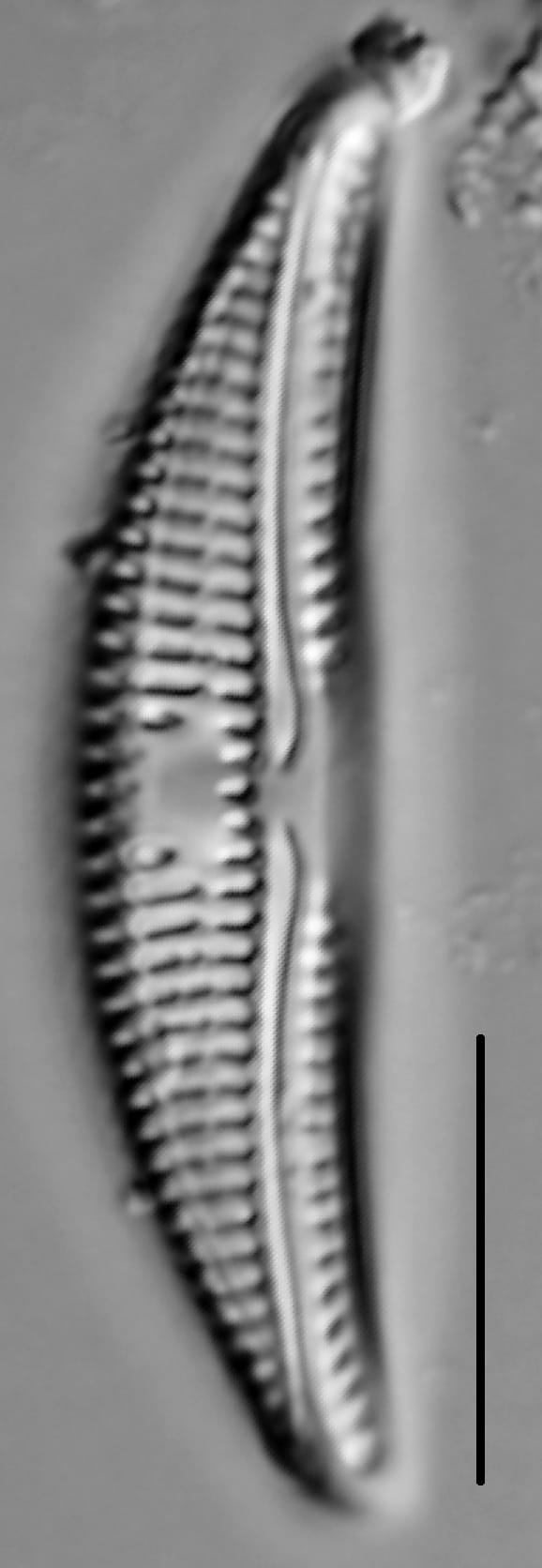 Amphora copulata LM5