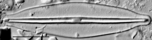 Frustulia crassinverva LM4