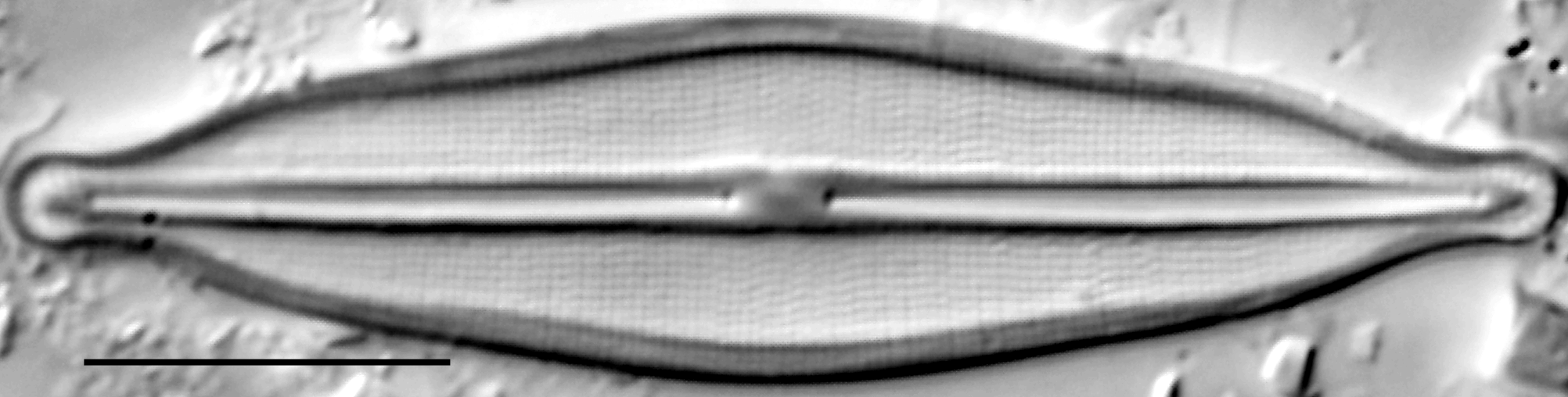 Frustulia crassinverva LM5