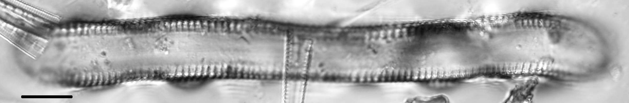 Cymatopleura Solea 1A Sccwrp